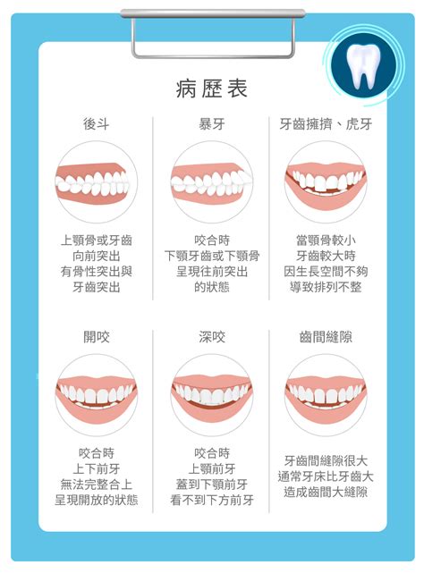 上下排牙齒平行|咬合不正怎麼辦？3分鐘認識咬合類型、症狀與矯正方。